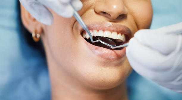 Best Broken Tooth Emergency  in Cambridge City, IN