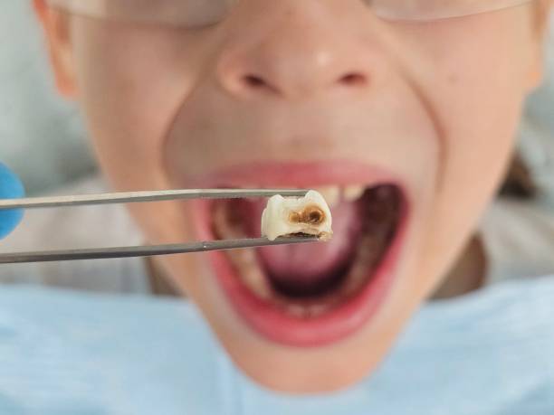 Best Tooth Pain Emergency Relief  in Cambridge City, IN